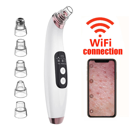 🌀 Smart Pore Vacuum with HD Camera – Watch Your Skin Get Clean! 🔍✨